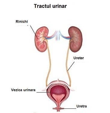 imagini litiaza renala